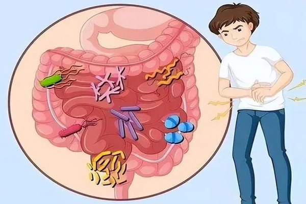 肠易激综合征最新指南